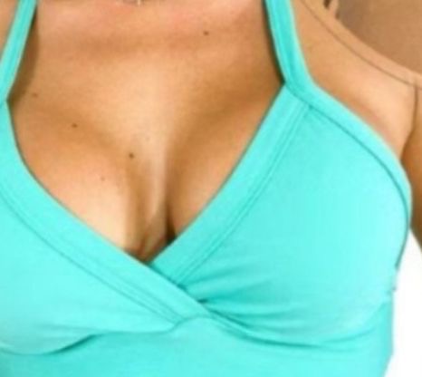 Tops  #10